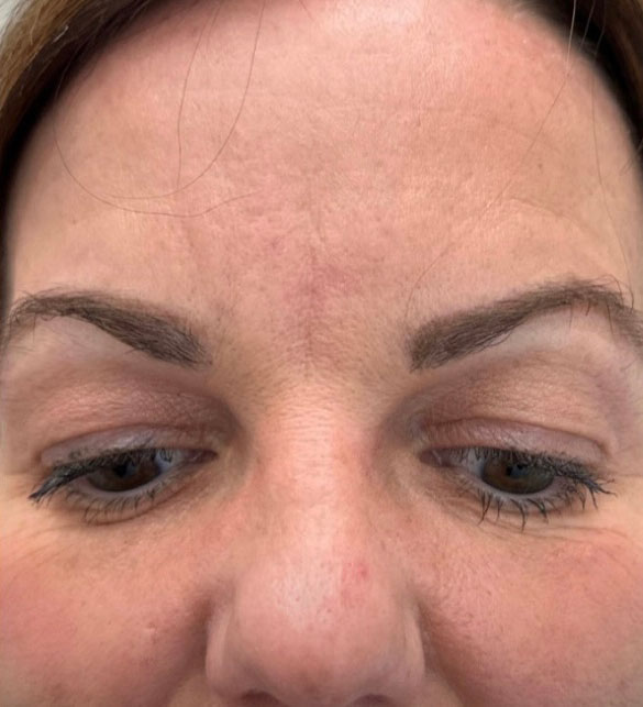 After treatment result 02