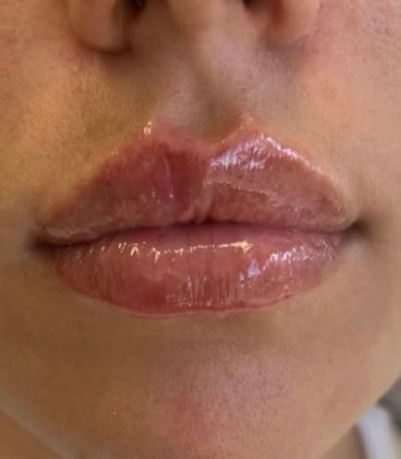 After treatment result 08