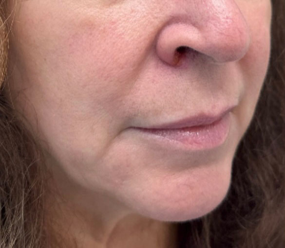 Before treatment result 03