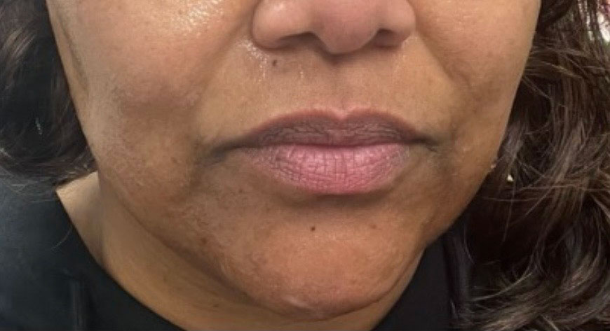 Before treatment result 05