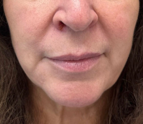 Before treatment result 06