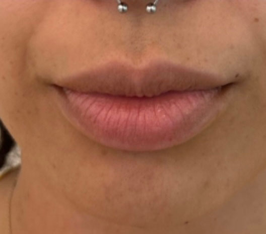Before treatment result 07