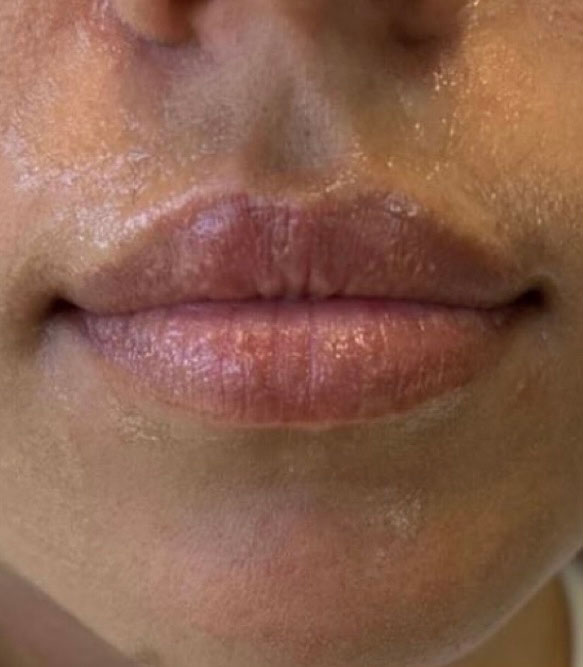 Before treatment result 08