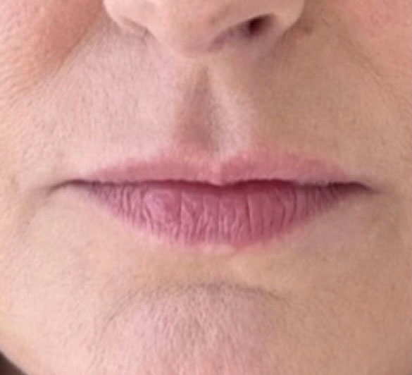 Before treatment result 09